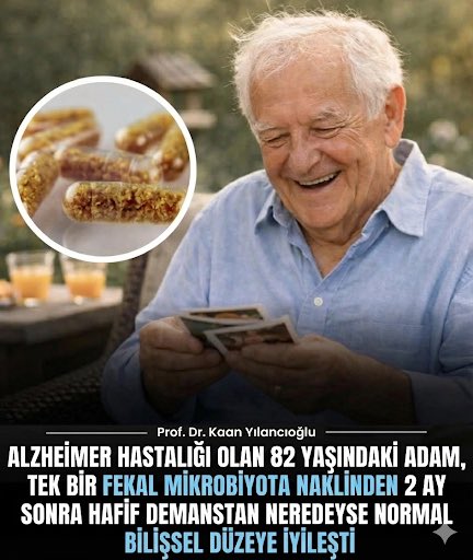 Bir vaka raporuna göre, 82 yaşındaki Alzheimer hastası bir adam, Clostridioides difficile enfeksiyonu tedavisi için eşinin dışkısından yapılan tek bir fekal mikrobiyota transplantı (FMT) sonrası 2 ay içinde hafif demans seviyesinden neredeyse normal bilişsel fonksiyona iyileşti.