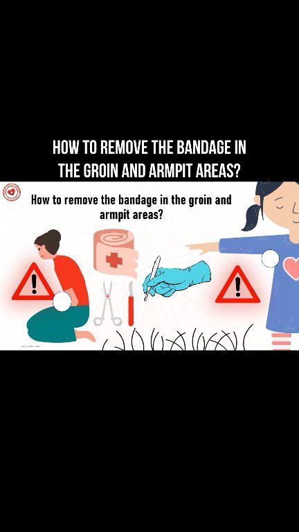 AllScientifical's tweet image. How to remove the bandage in the groin and armpit areas? #bandage #surgerytips #surgeon #operation ... Continue to: facebook.com/reel/203393283…