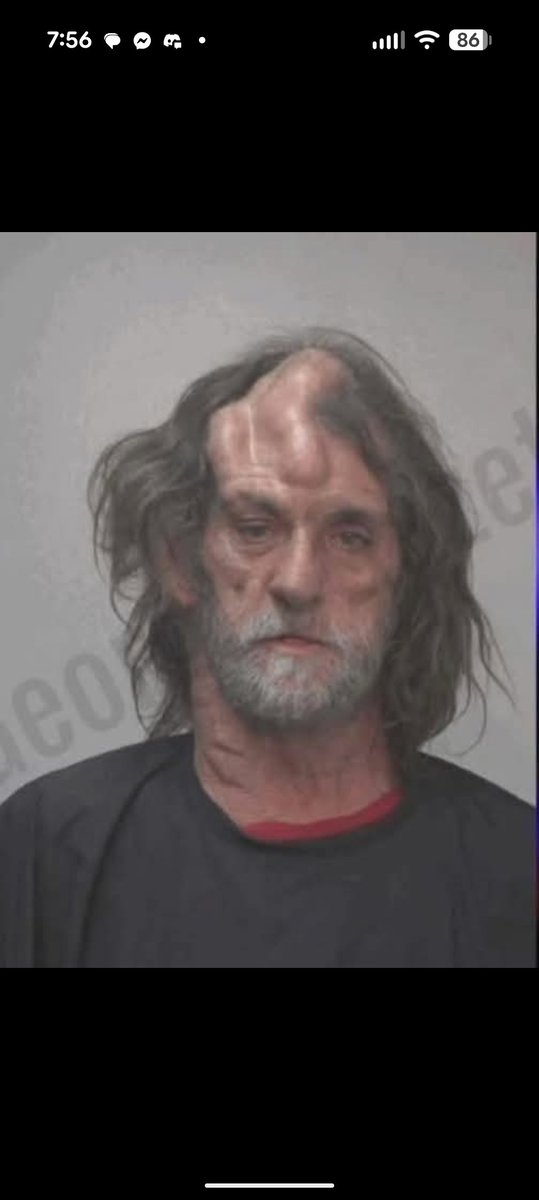 TimBitterman's tweet image. Meet dick head. He is real whoop whoop #champenergy @BuffaloFAMbase @icp @ICPhotog