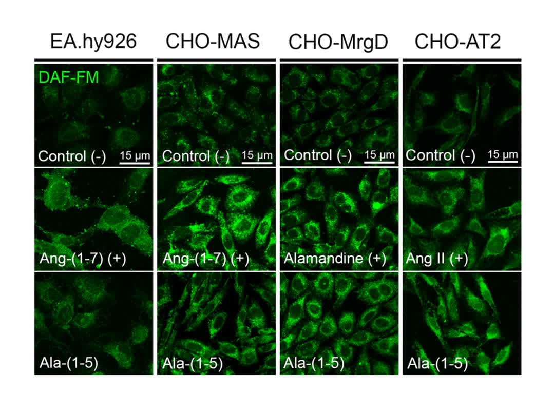 CircRes's tweet image. Santos et al found that #alamandine-(1-5) has distinct characteristics that differentiate it from the conventional #RAS pathways responsible for reducing #BloodPressure. Find out more at ahajrnls.org/49imnJD
@cexercicio @labivasc @danilopereira @sergio_scalzo