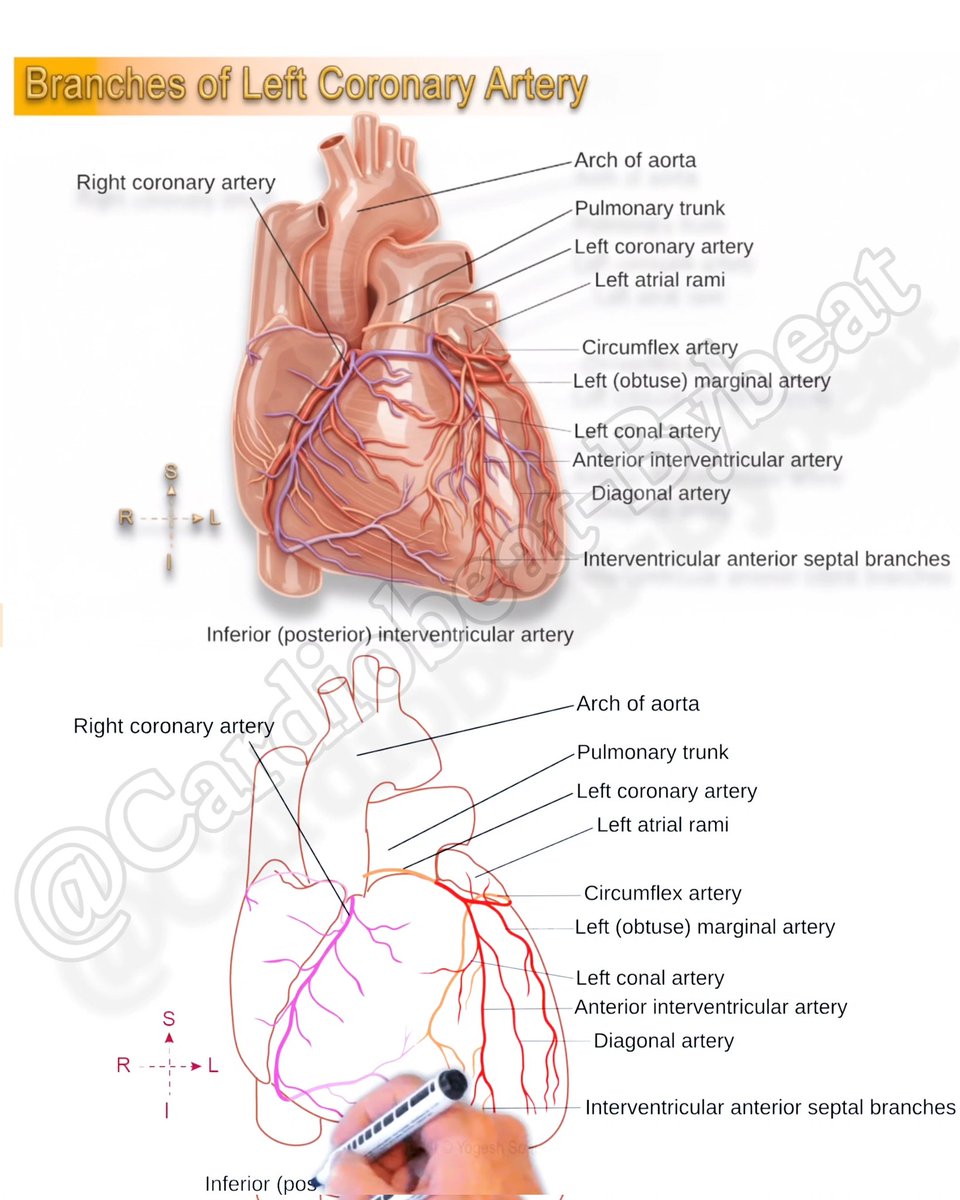 CardioBeat_'s tweet image. facebook.com/share/r/17t3PW… 👈🏻 🆕 Visual: Left Coronary Artery (LCA) Branches
This schematic details the LCA's origin from the left aortic sinus and its bifurcation:
#Cardiology #Anatomy #LCA #CoronaryArteries #MedEd