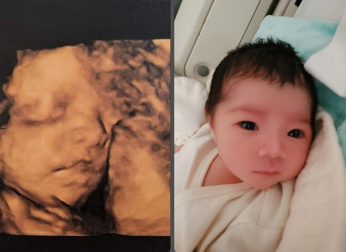 Mr.kindness (Ekin Lee) tweet media