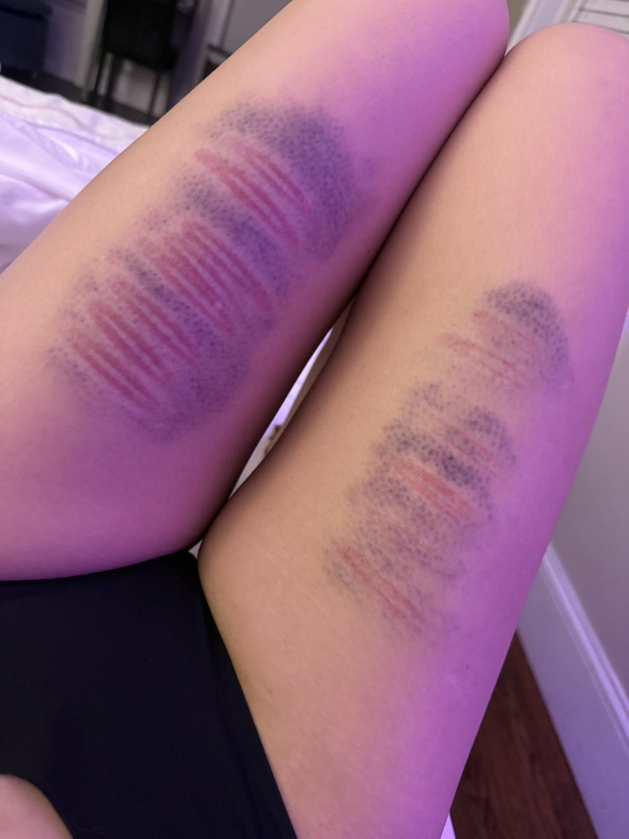 Alana Noex tweet media