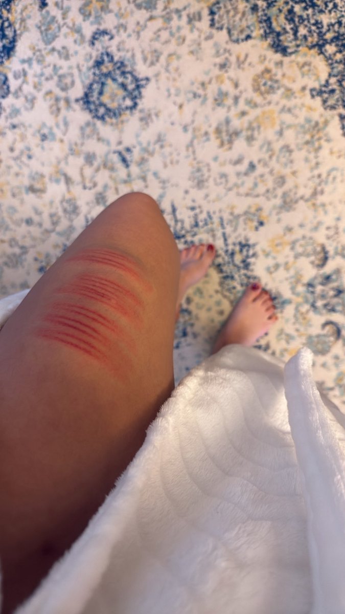 Alana Noex tweet media