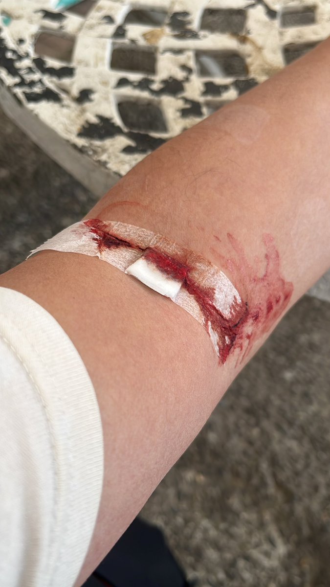 打過十幾次顯影劑，第一次遇到這種狀況。
然後櫃檯只會叫我壓著。
鐵打的病人、流水的護理人員。
#台中榮總