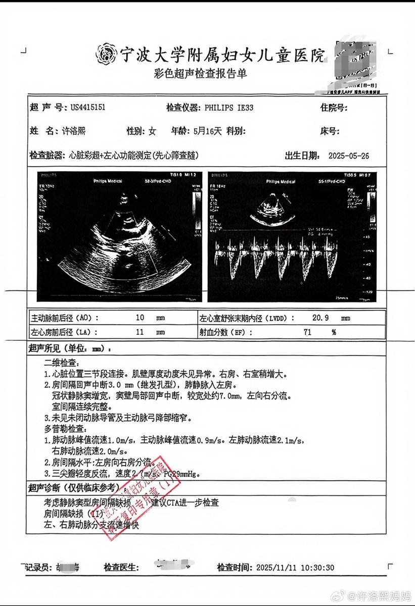 Liz_Legendd's tweet photo. 这是2025年12月7号院方给到我们的术前心脏彩超原始影像资料，还有CTA。
有没有专业的心脏彩超或心外科医生，帮忙解读一下影像图片和录像！🙏🙏🙏
通过网盘分享的文件：CTA原始影像
链接: https://t.co/rrpAQv3ve0 提取码: 7777 
--来自百度网盘超级会员v1的分享 
#宁波 #小洛熙 #医生 https://t.co/UZhJN6vgpN