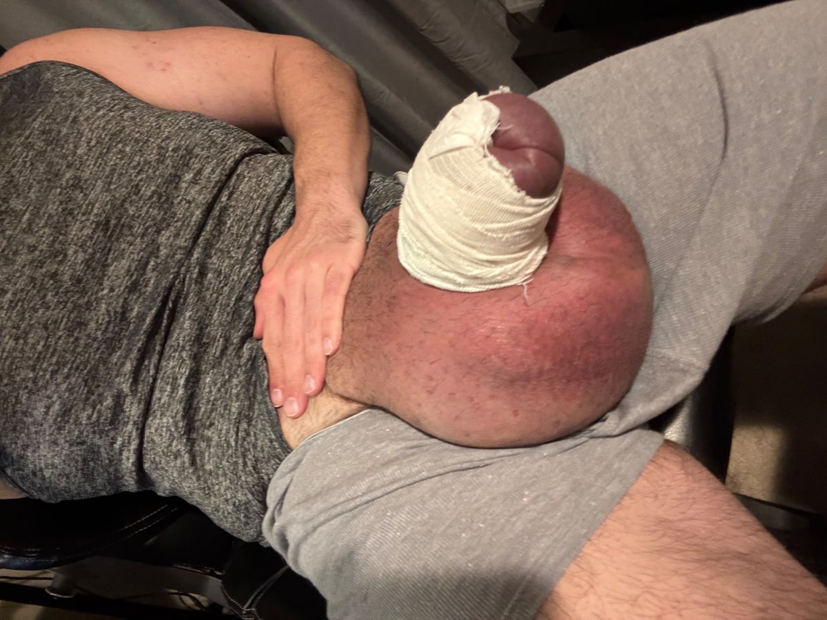 Lorg Dog tweet media