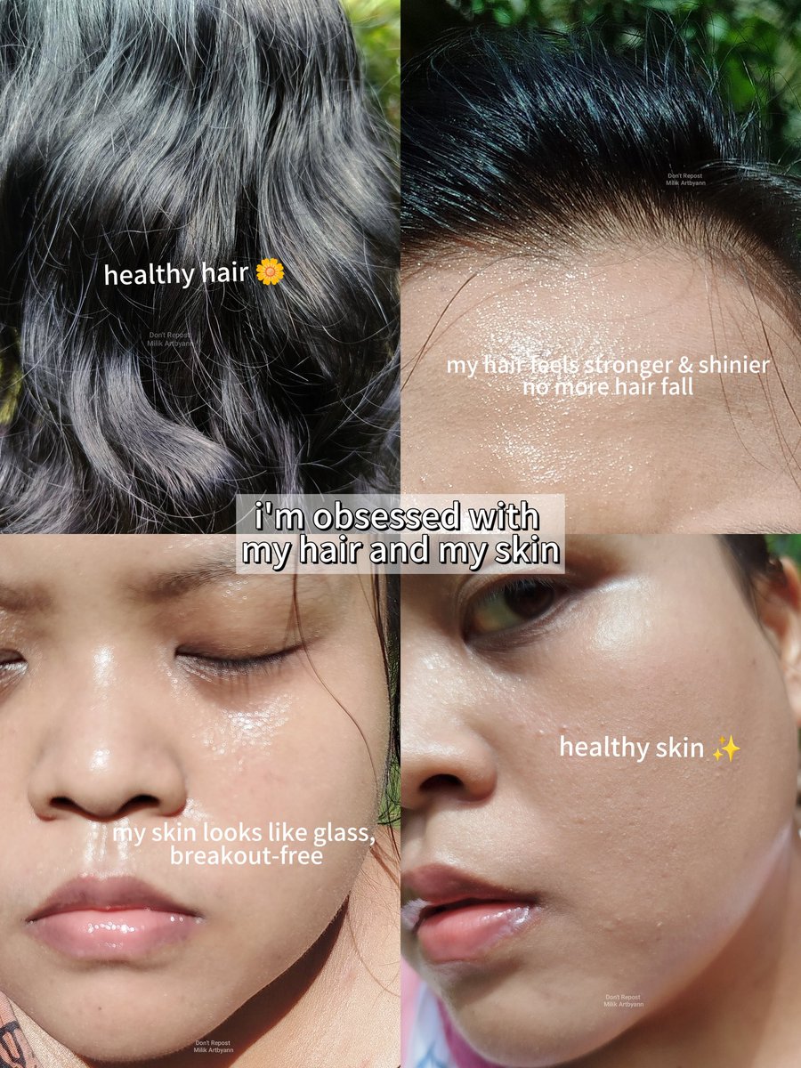 Artbyann_'s tweet photo. when breakouts and hair fall happen together, internal support really matters 💛✨ https://t.co/lbBr9xPBRf