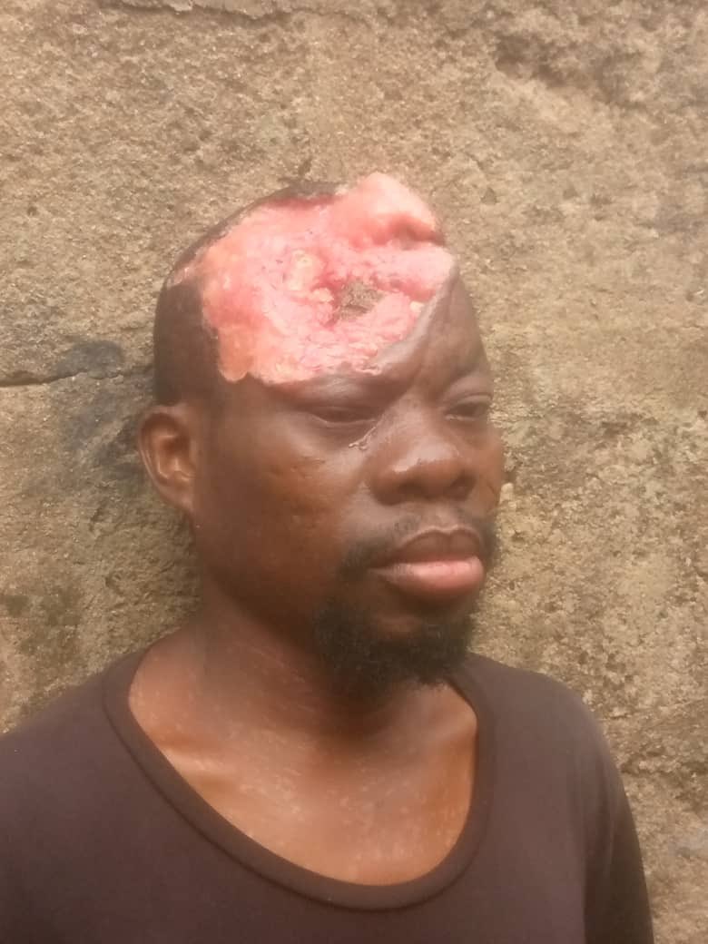 As we are celebrating Christmas, use this Moment to Support Idrisu with GHc100 to help let’s Save his Life. He only needs GHc40,000 and we now have raise GHc1,500 and left with GHc38,500. 
Please No amount is too small to Support. 
Let’s do it together Now. 
𝗗𝗶𝗮𝗹 *713*034# OR