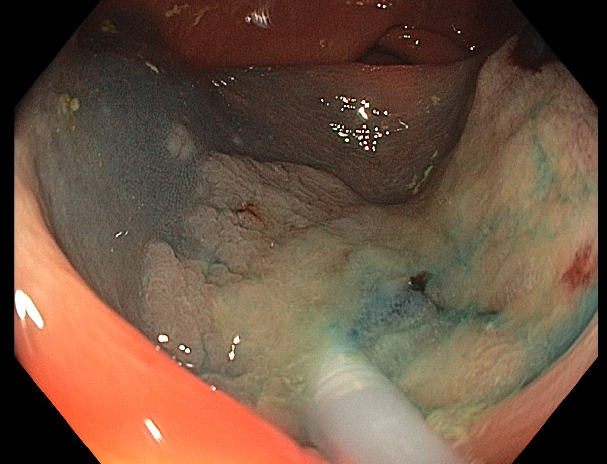 Aleksandar Gavric tweet media