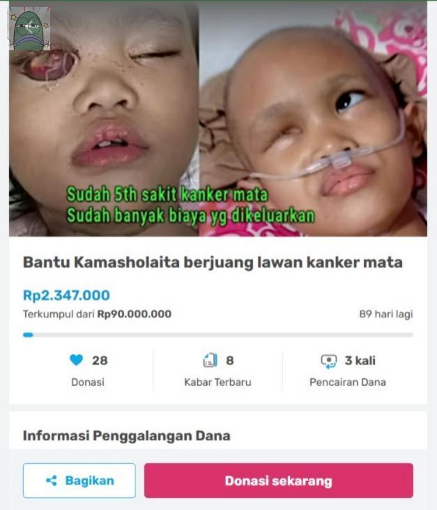 [URGENT] Perjuangan Ola (5th) Lawan Kanker Mata 
Mata kanan sudah diangkat, namun kanker kambuh lagi. 💚

Mari bantu Ola sembuh &amp; bisa sekolah TK🙏