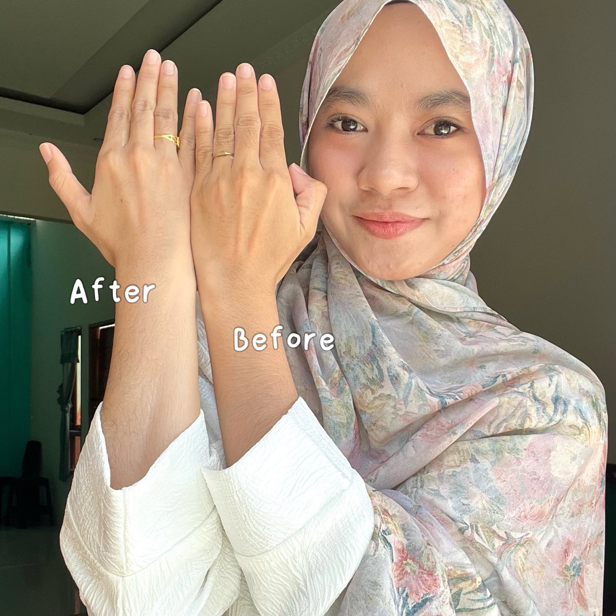 rosebumbby's tweet photo. This product actually WORKED for me… my hands look so much more even now 🤍 https://t.co/QBLV5mECYI