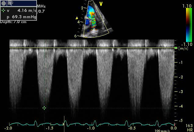 CardiovascularCorner tweet media