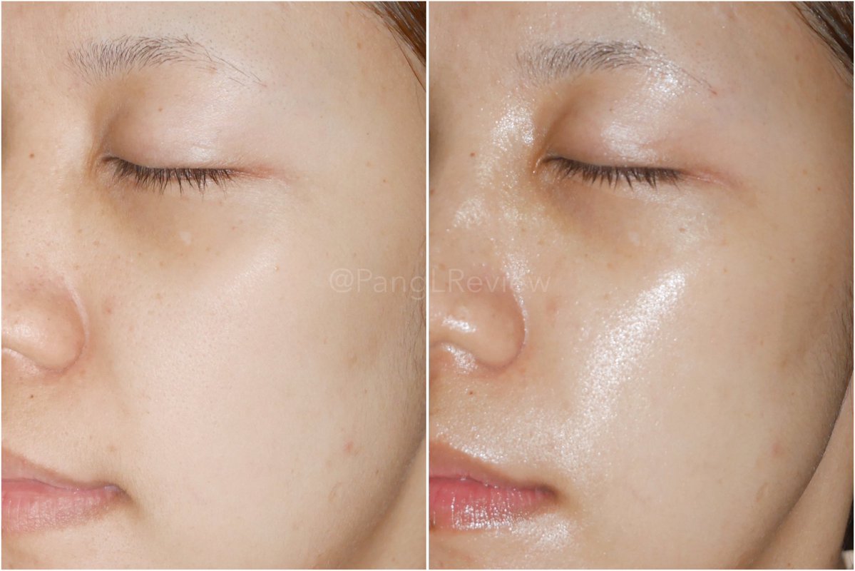 PangLReview's tweet image. อมก.!!! ไม่คิดว่าจะใช้ดีขนาดนี้ ทั้งที่เนื้อแอมพูลบางเบา แต่ให้ผิวที่ชุ่มชื่นแบบมากกกกอ่ะ และยังช่วยปลอบประโลม เสริมเกราะป้องกันผิวให้แข็งแรงด้วย แพคเกจเดิมเค้าเป็นแบบ dropper แต่อันนี้เปลี่ยนเป็นหัวปั๊ม ซึ่งใช้ง่ายกว่าเดิม แป้งลองใช้ก่อนแต่งหน้า รู้สึกว่างานผิวลงง่ายขึ้น…