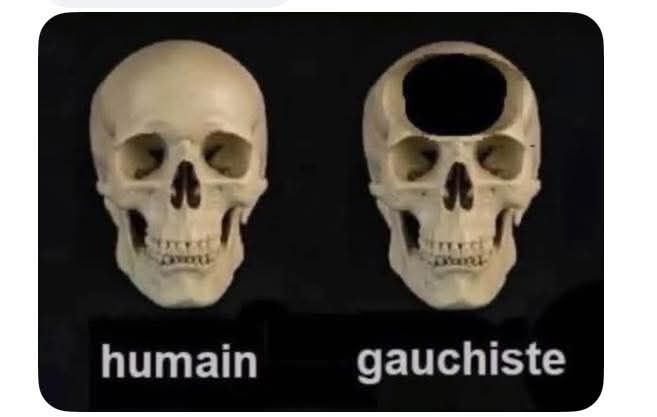 Je comprends mieux !! 😜😜⏬🤣🤣🤣