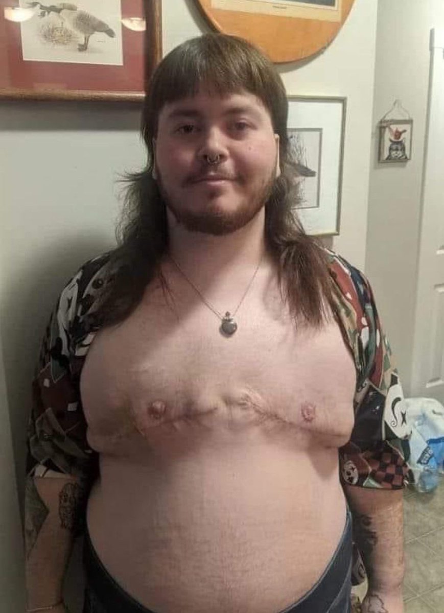 libsoftiktok's tweet image. This is what “healthcare” is according to Democrats