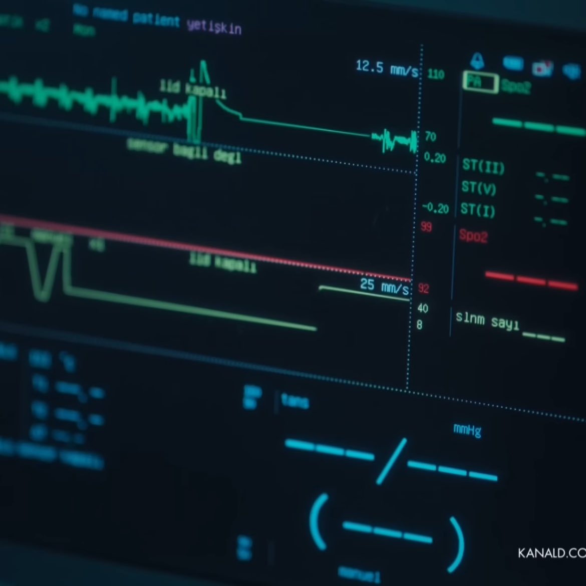 Ne yaptınız parmağından mı çıkarttınız sensörü 
#esrefrüya