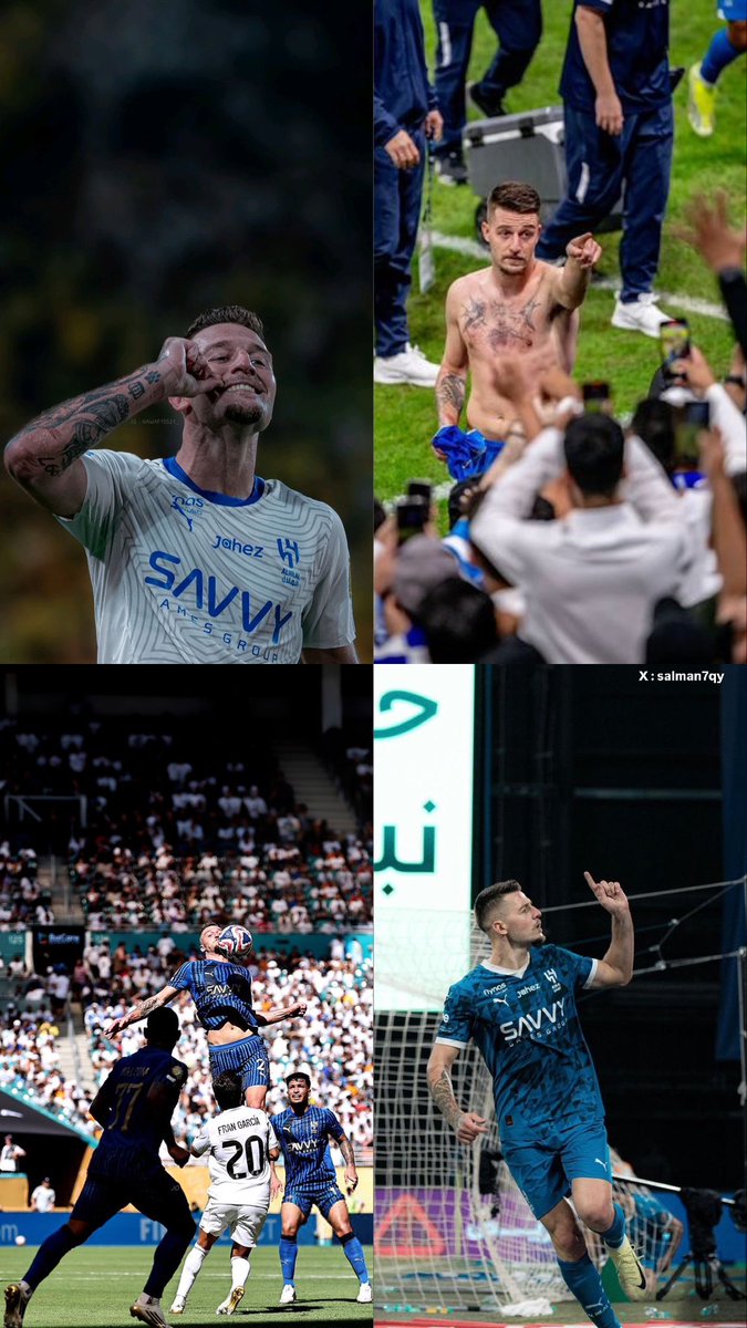 Wooow! 🤯🥶🤩💙💙