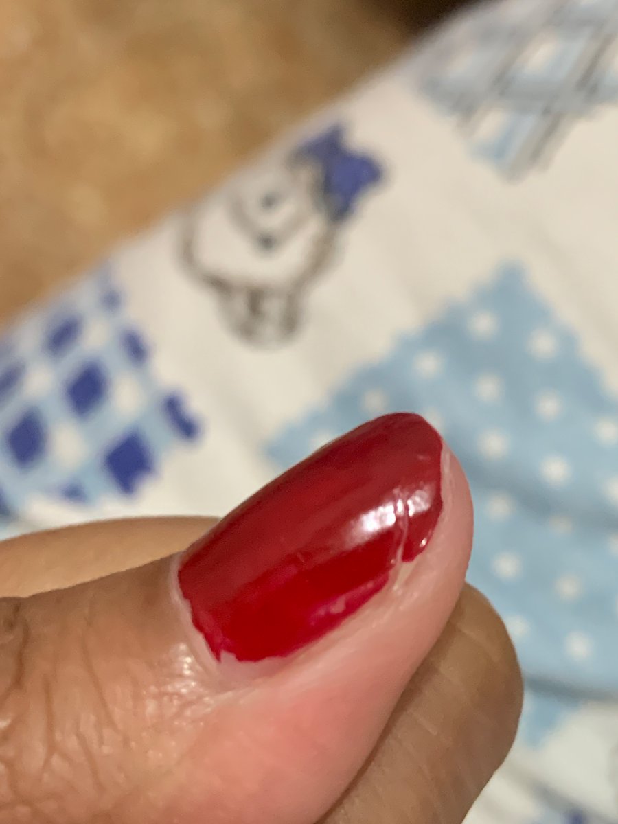 ilybutnotyet's tweet photo. Ibu jariku yg kanan dan kiri pendek bgt parah gara2 copot di tengah2, sakit bener woy.. mana buat ngetik susah dan typo mulu faghhh 🫠 https://t.co/2gQm5s84ww