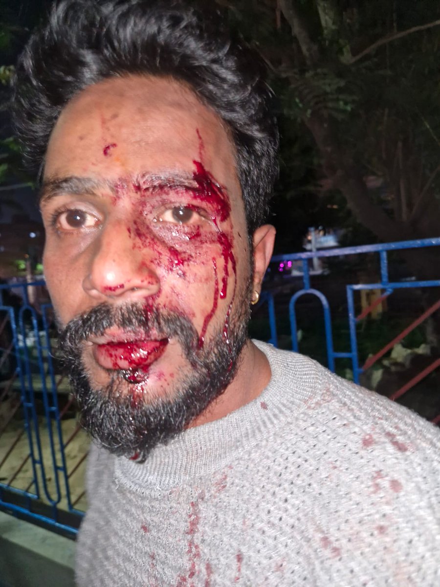 বোলপুরে বুকে আবারো জিহাদীদের দ্বারা আক্রান্ত হিন্দু!

কাজ করে বাড়ি ফেরার পথে দশ বারো জন জিহাদি গাড়ি থেকে টেনে নামিয়ে হামলা চালাই শুভজিৎ দলুইকে কারণ সে হনুমান মন্দির ভাঙার প্রতিবাদ জানিয়েছে বেশ কিছুদিন আগে। বাংলাদেশের একটা ছোট্ট আভাস বোলপুর দেখলো।
<a href="/me_sourish_/">Sourish Mukherjee</a> <a href="/SuvenduWB/">Suvendu Adhikari</a> <a href="/ABP/">Adam Poswolsky</a>