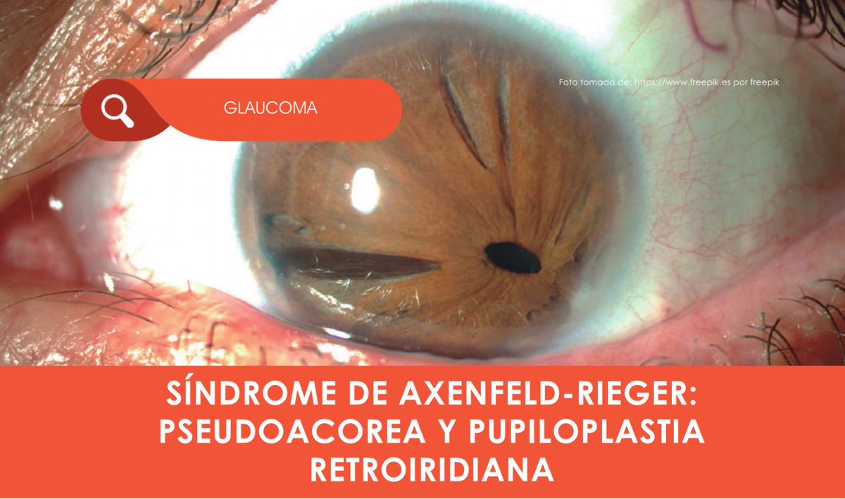 voltagebone's tweet image. Headcanon that Diavolo either has Acorea or Pseudoacorea