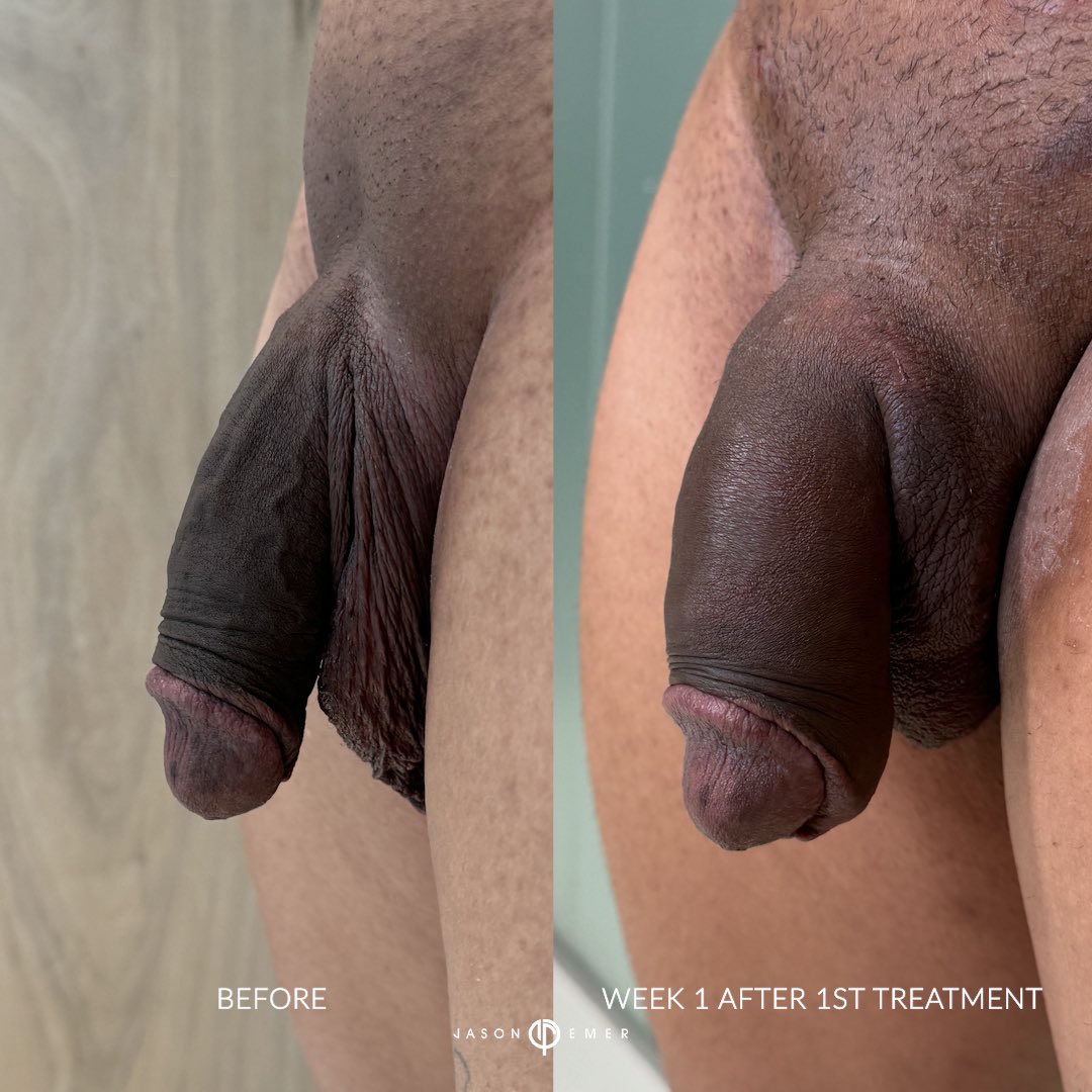 JasonEmerMD tweet picture