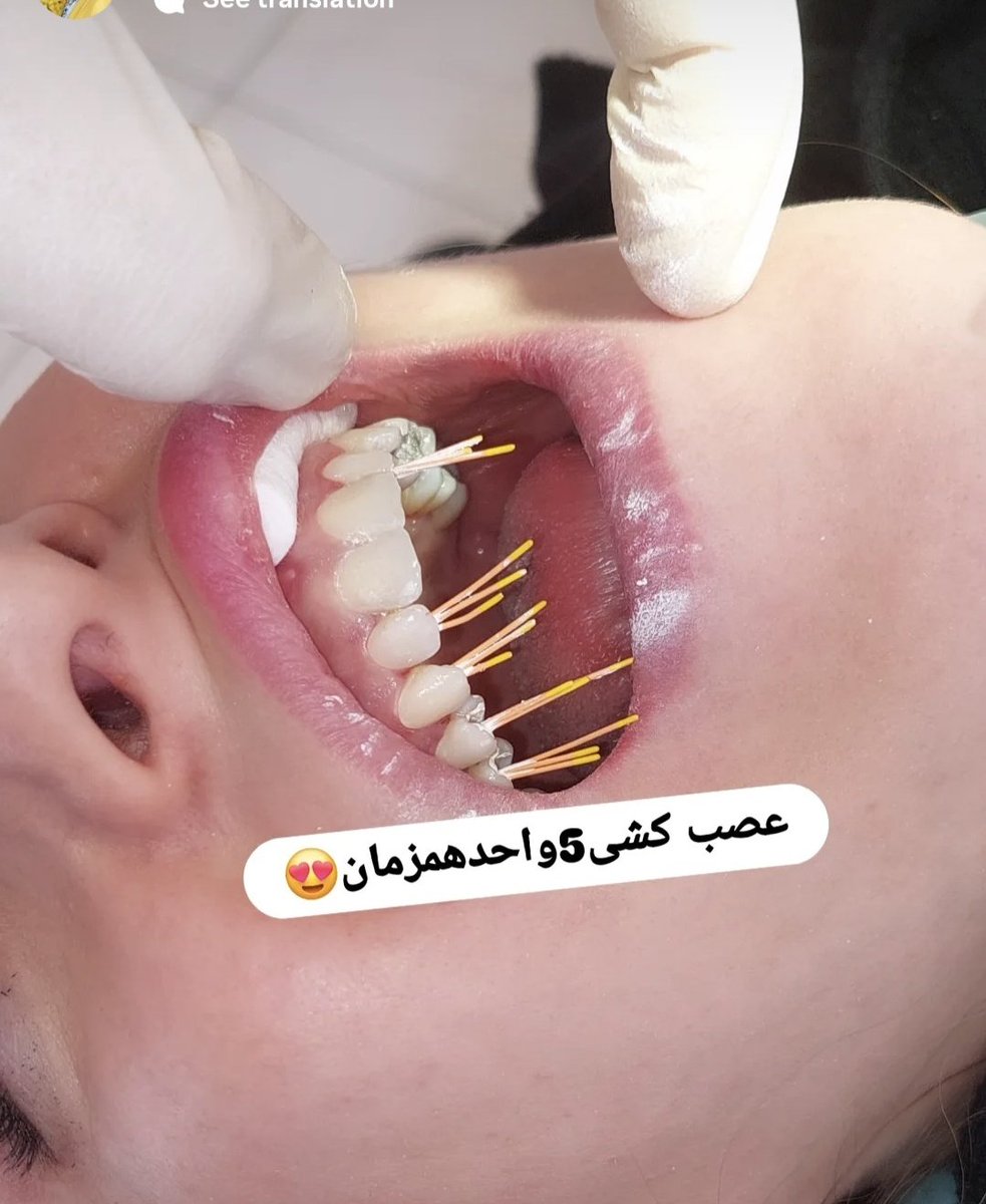 تاد چاوز tweet media