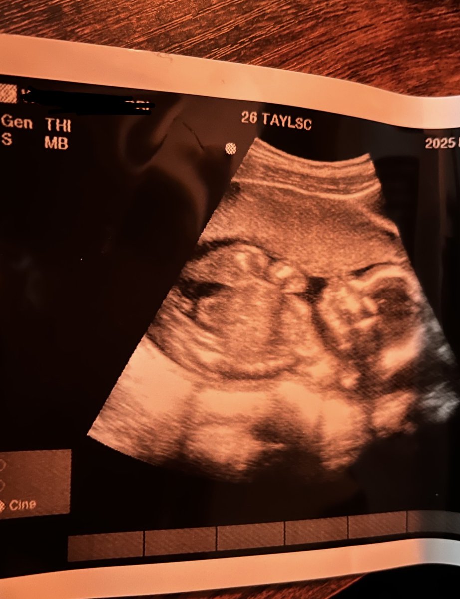 scarscribbles_'s tweet image. This #ChristmasDay🎄, I came to grasp just how incredible God’s sacrifice for us truly was, and the beauty of Mary’s #obedience… I thought to myself: if someone asked me to sacrifice this baby boy in my womb for the horrific sins of the whole world, I’d say “absolutely not!”