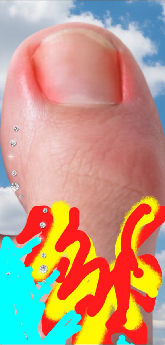 AlvoidMatthew's tweet image. Original art for ya...
"Missile toe" 😎