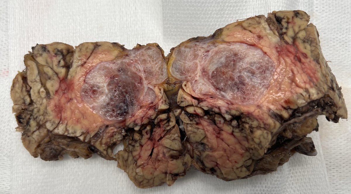 Anthony J Gill tweet media