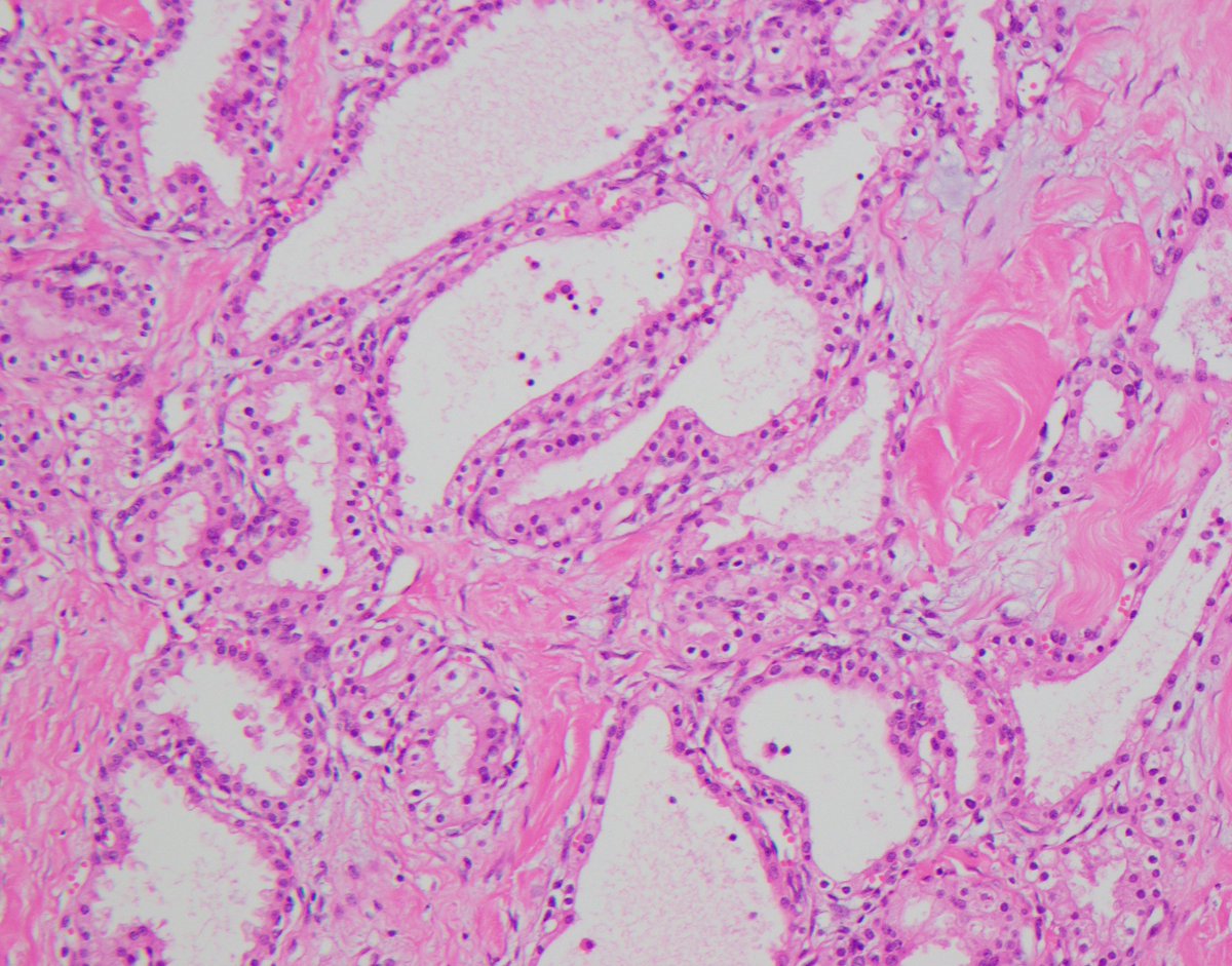 Anthony J Gill tweet media