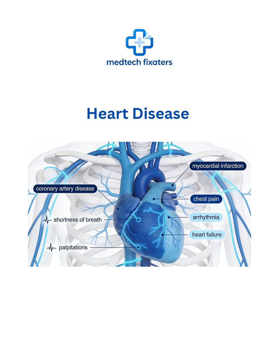 MedtechFixaters's tweet photo. Heart Disease follow for more.
#MEDTECH #medtwitter #medtechfixaters https://t.co/43QR2oaJ1i