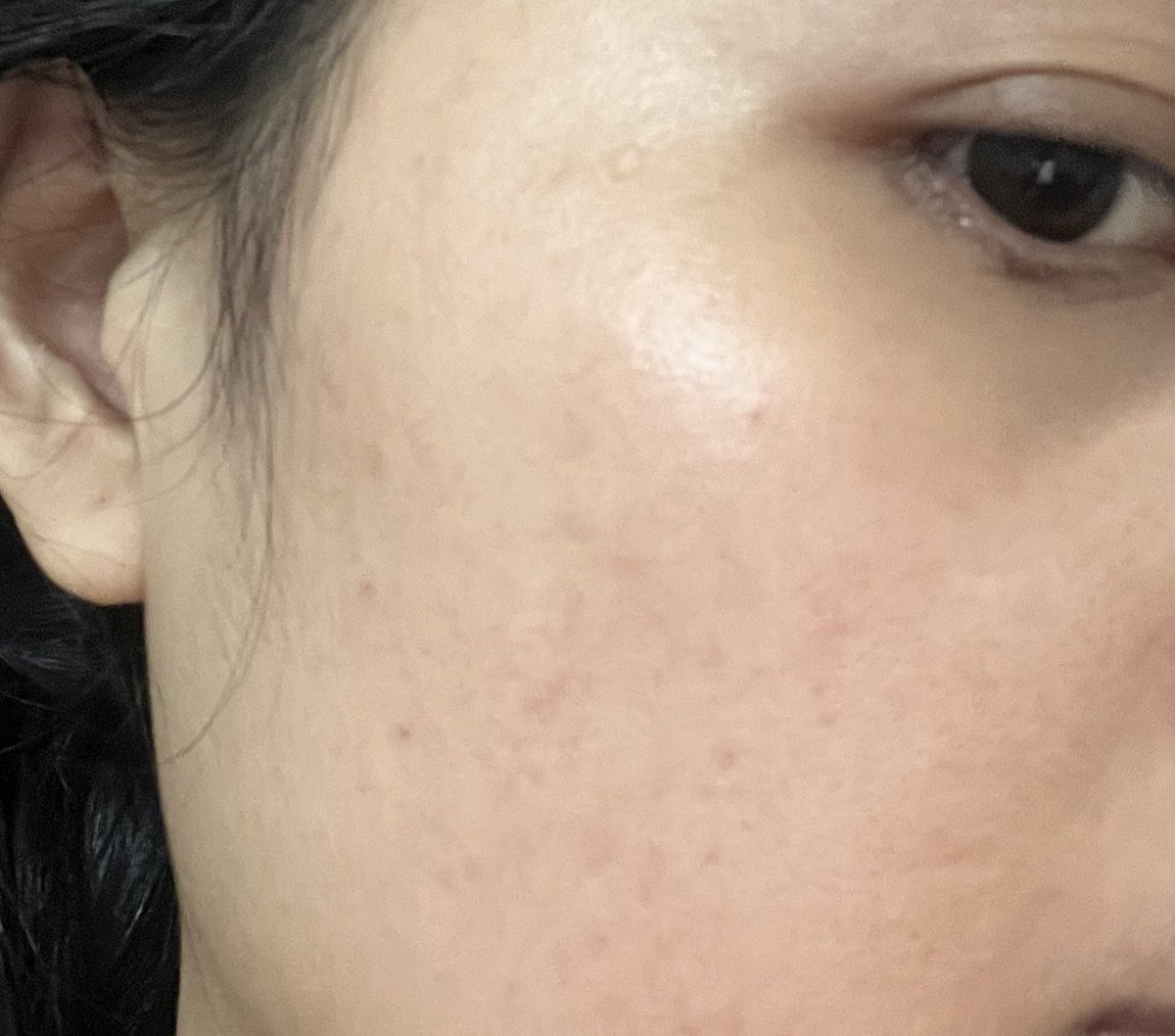 aadrrrrrrr's tweet photo. jarang ngeluarin produk baru. produk itu itu aja tapi bagus. bukan produk yg seminggu udh ada hasilnya, tapi pelan pelan baru hasilnya keliatan. toner dan serum terbaik jatuh pada alpha arbutin dan exfoliating🫶🏼 https://t.co/utAYS9Lk95