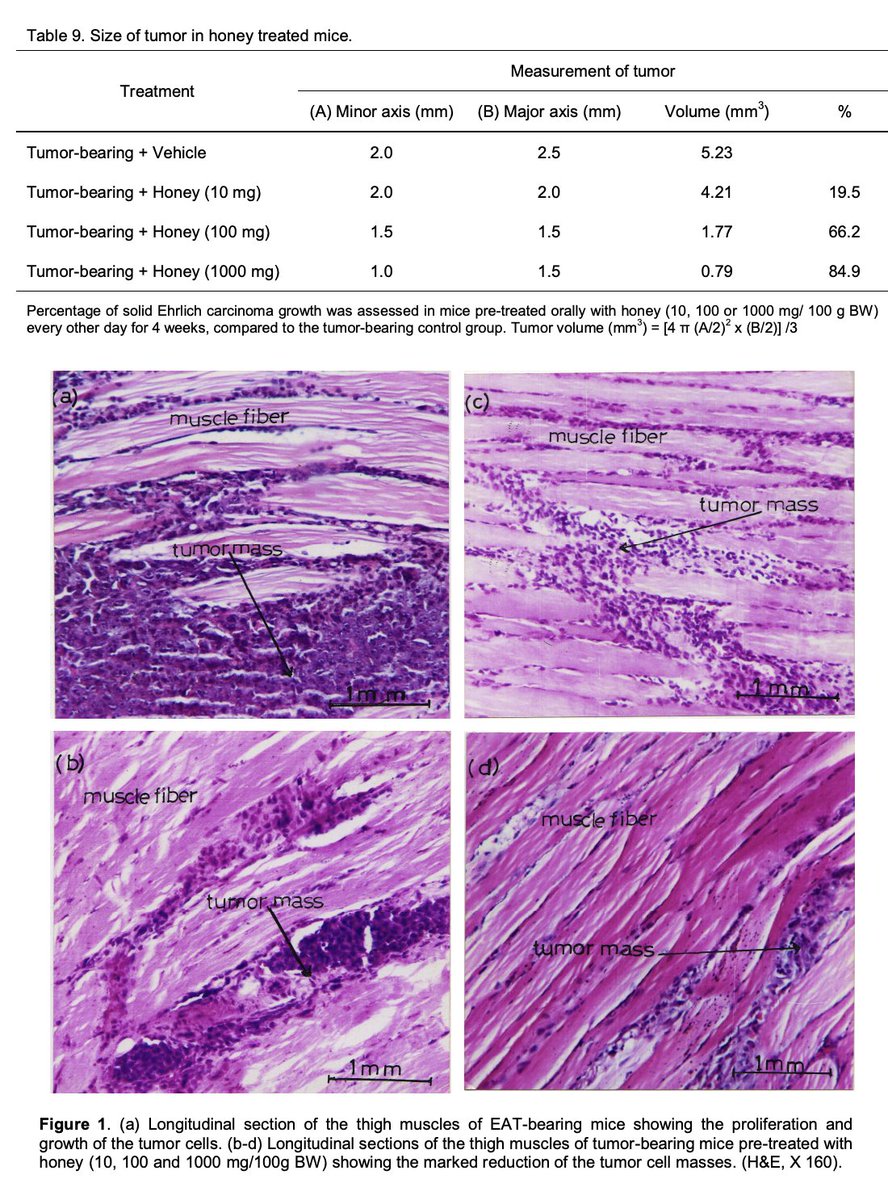 Outdoctrination's tweet photo. Raw honey shrinks tumors by 85%. [study]

Honey improved anti-cancer immunity by:

• Improving phagocytic activity (macrophages)
• Stimulated B & T cell production in bone marrow
• Increased antibody production

due to its unique phenolic compounds.

A broad spectrum immune enhancer.