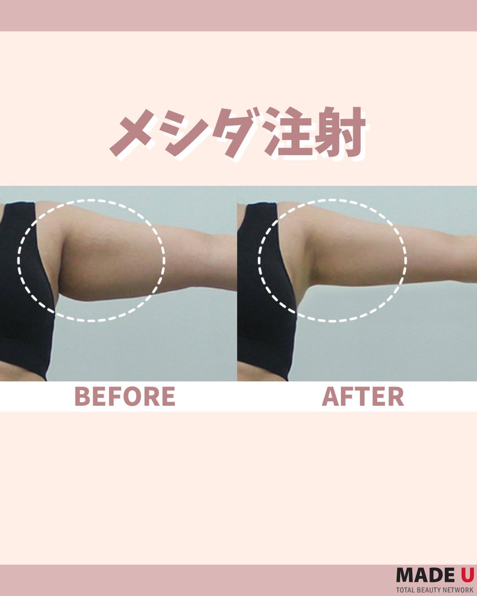 メイドユー　メシダ 皆様、こんにちは🌷 毎日綺麗になるメイドユー江南店です 本日はメシダ