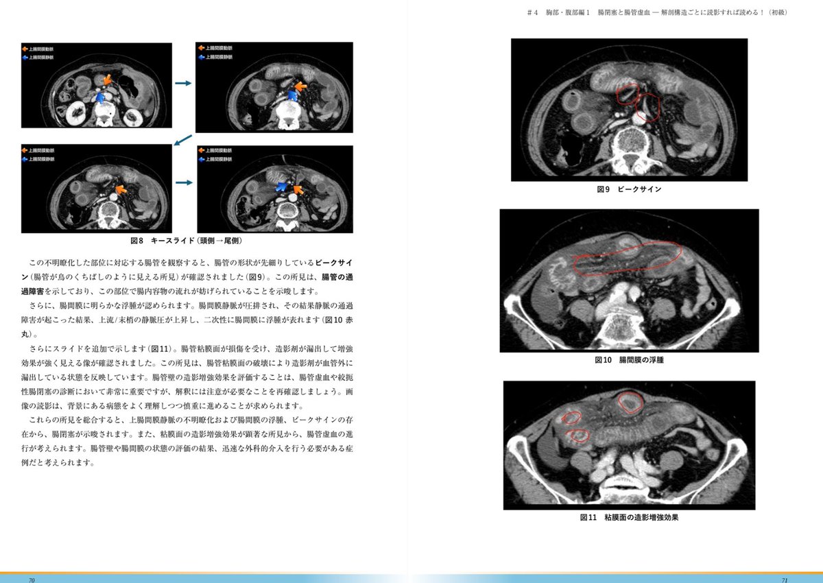 T Sekine tweet media