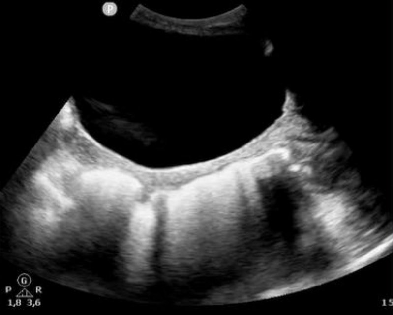 TheFrenchPOCUS tweet media