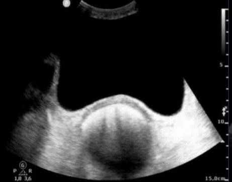 TheFrenchPOCUS tweet media