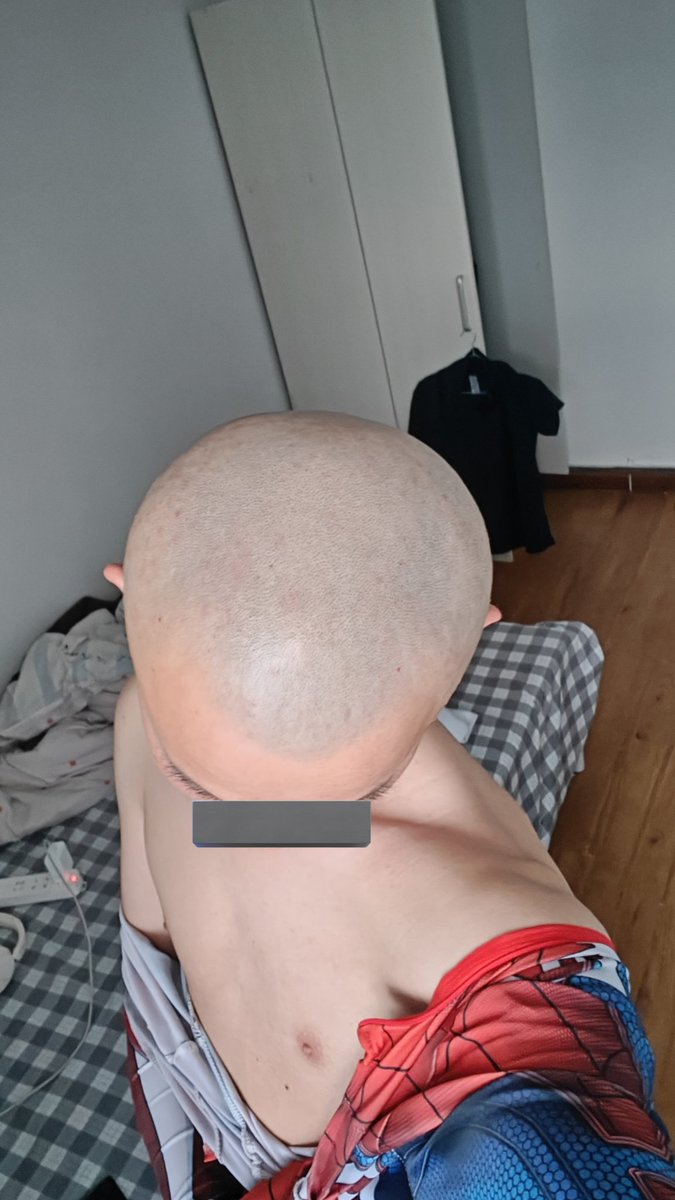 augustbeimo's tweet photo. #headshave #bald #剃光头 #光头 https://t.co/hhSg7MNBT8