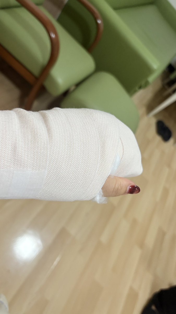tkapo_'s tweet image. อยากลงไว้เป็นเรื่องเล่า/อุทาหรณ์ ว่าแมวกัดมันไปสู่ผ่าตัดมือได้ยังไง 😭

เริ่มจากนี่โดนแมวกัดจมเขี้ยว 4 รูที่นิ้วกลางและโคนนิ้ว เลยรีบไปรพ.ทันที วันแรกล้างแผลแล้วกลับบ้าน ฉีดวัคซีนตามปกติ วันที่ 2 ก็ยังไปล้างแผลอยู่ แต่หมอเจอความผิดปกติในวันที่ 3 ว่าแผลบวมไม่ยุบ มีหนอง