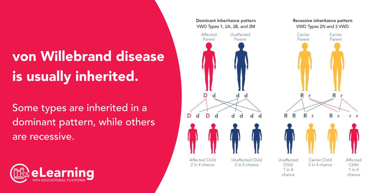 wfhemophilia's tweet photo. Did you know: von Willebrand disease is passed down through the genes of either parent to a child of either sex. Some types of VWD are inherited in a dominant pattern, while others are inherited in a recessive pattern. Learn more: https://t.co/du6viy2FBb https://t.co/goG57LQaEP