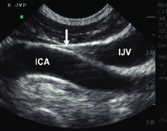 Ross Prager tweet media