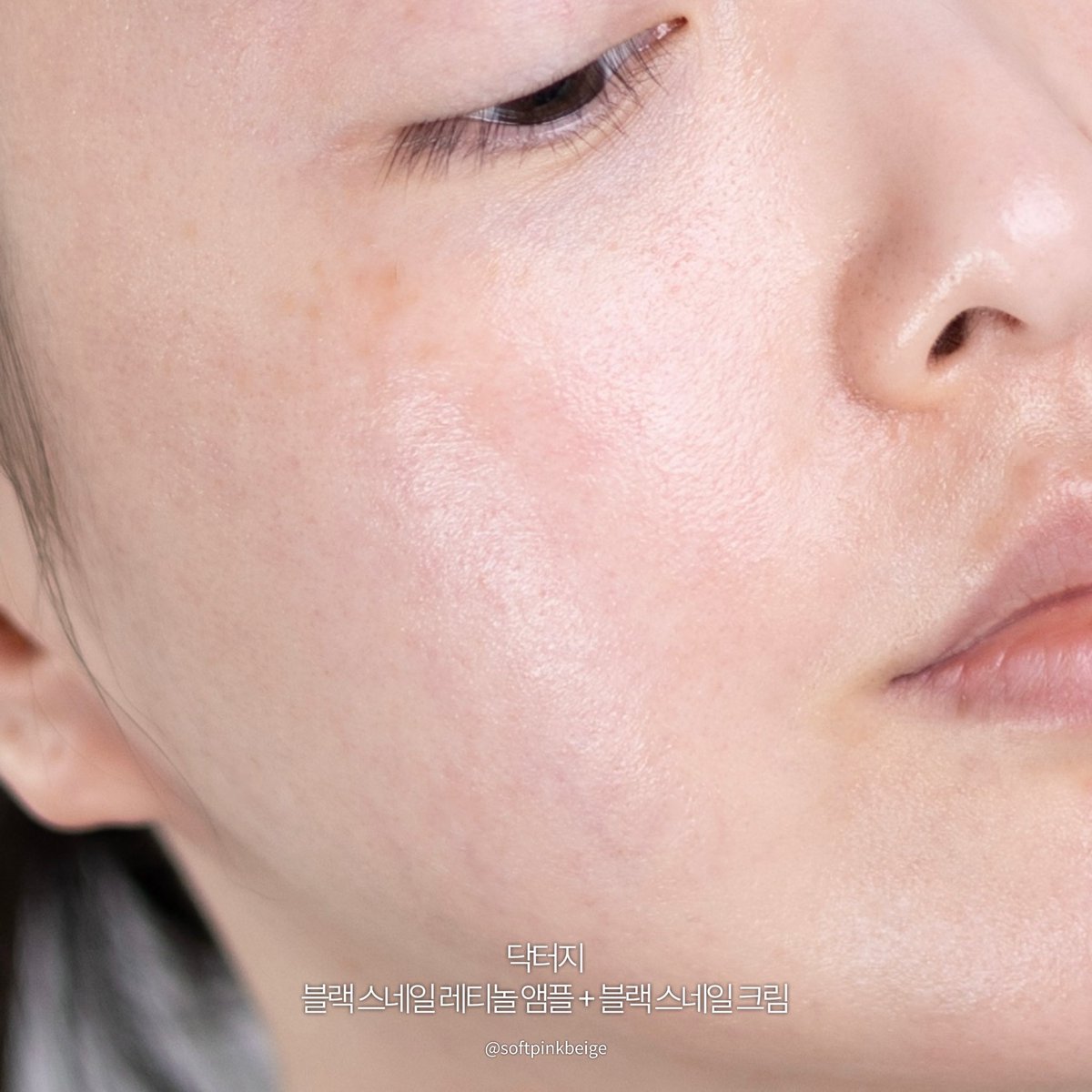 softpinkbeige's tweet image. #유료광고 #RT이벤트 @drg_kr_official 
 
⭐️리트윗 추첨 5분께 #닥터지 블랙 스네일 레티놀 앰플 본품을 드려요🐌
 
프나 이나경님 이번 화보컷 아름답다….
겨울에 촉촉한 메이크업 너무나 찰떡(◝‿◜)
 
탄탄한 영양과 보습감에 탄력까지 챙겨가는 겨울 속광 조합...🐌
프나 이나경님도 픽한…