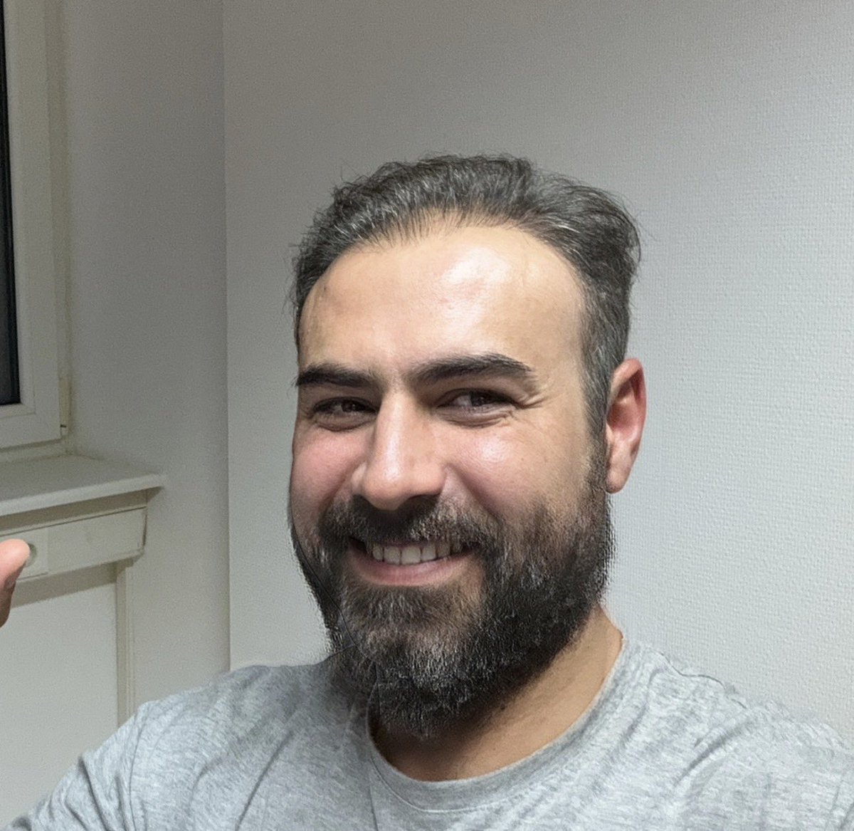 Sakallı ben. Sakalları batan bir monster adeta aq