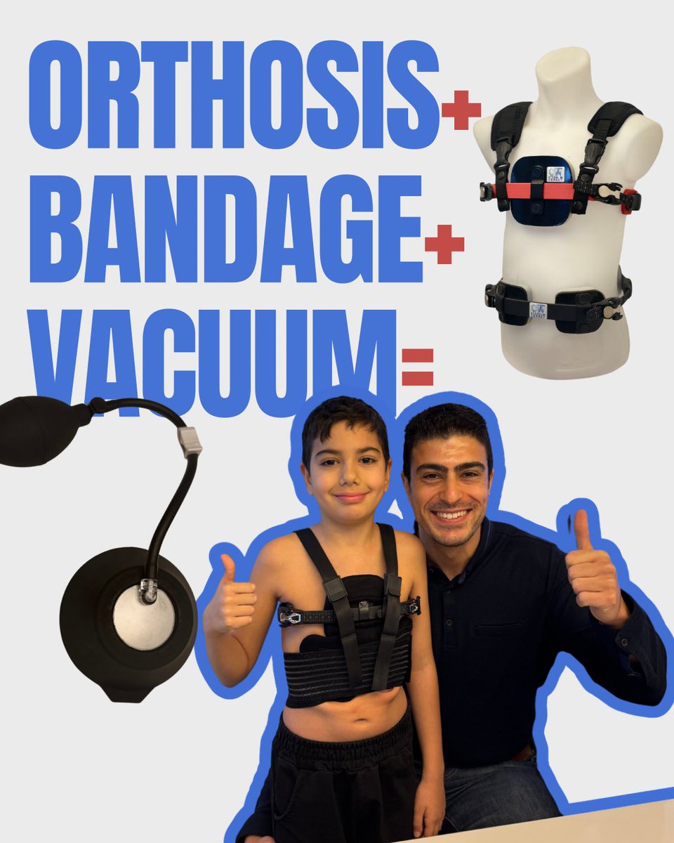 drpektus's tweet image. Thoracic dystrophy (narrow chest cage) may occur when the chest cage is not wide enough, causing the heart to push the chest wall outward in order to create sufficient space.

#chestwall
#orthosis
#vacuumtherapy
#bandage
#medicalinformation
#healthawareness