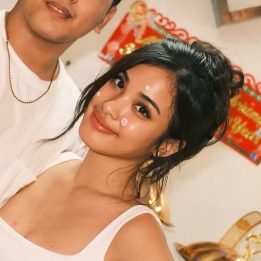 shuvee and her pimple patch against the world