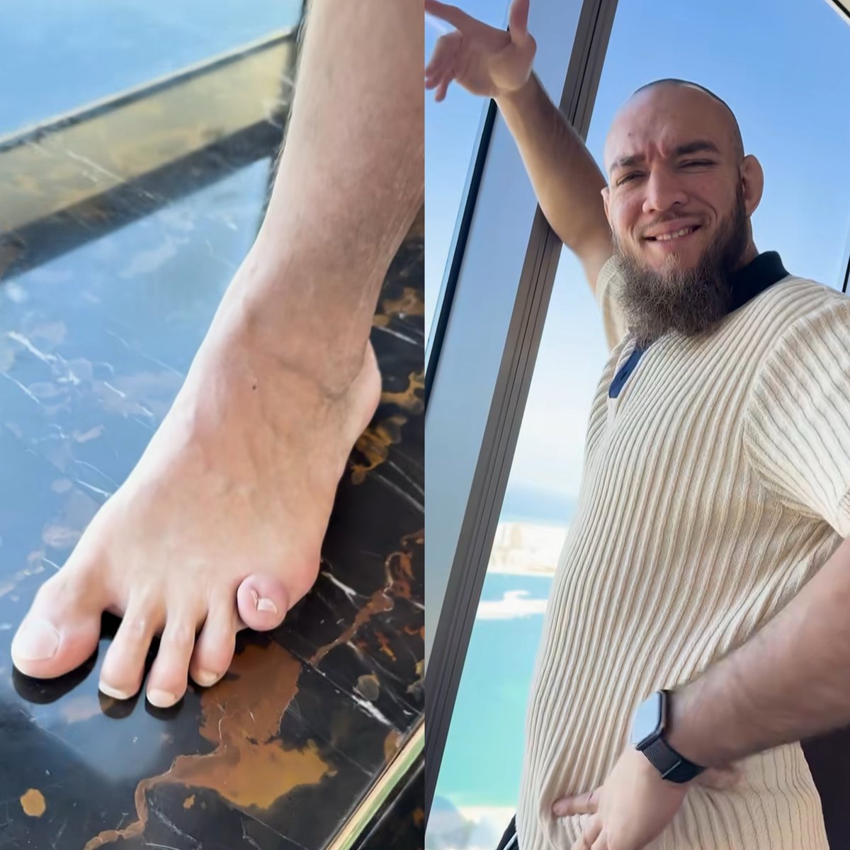 FightVaults's tweet image. Valter Walkers toe looks… normal