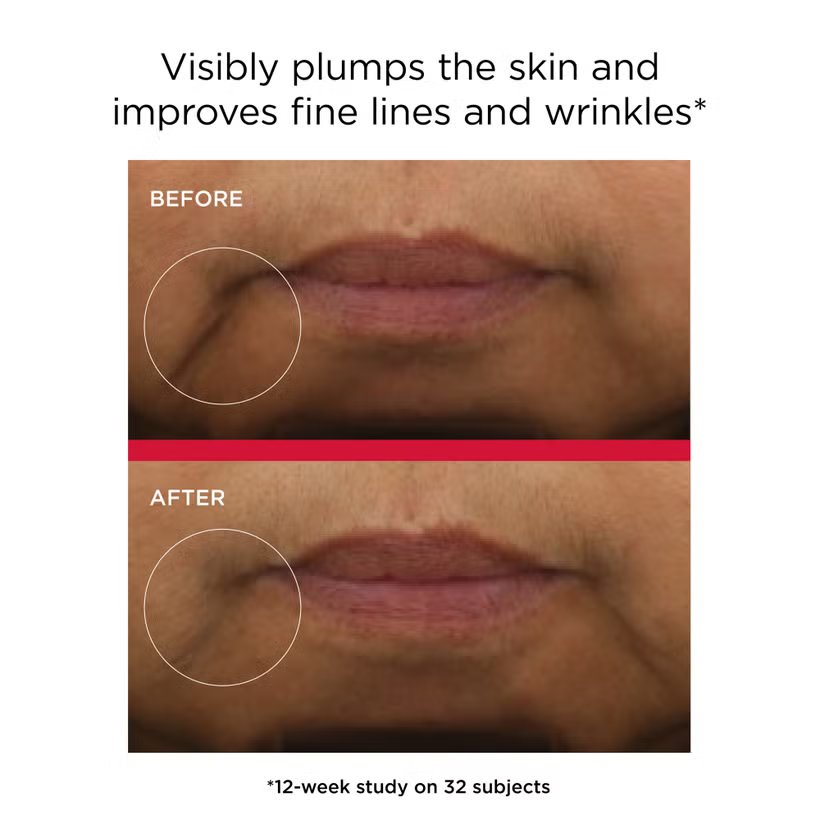 abspixelbd's tweet image. EltaMD UV Daily Hydration

Product Link: qily.ink/ZSFs9

Daily, lightweight hybrid SPF 50 with the proven efficacy of a hydrating serum*, providing advanced sun protection and clinically proven hydration in one product.
#heatedrivarly
#skincareusa
#USA