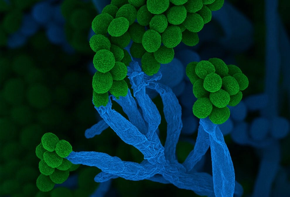 Pinselschimmel zur „Mikrobe des Jahres“ 2026 gekürt (bdw)