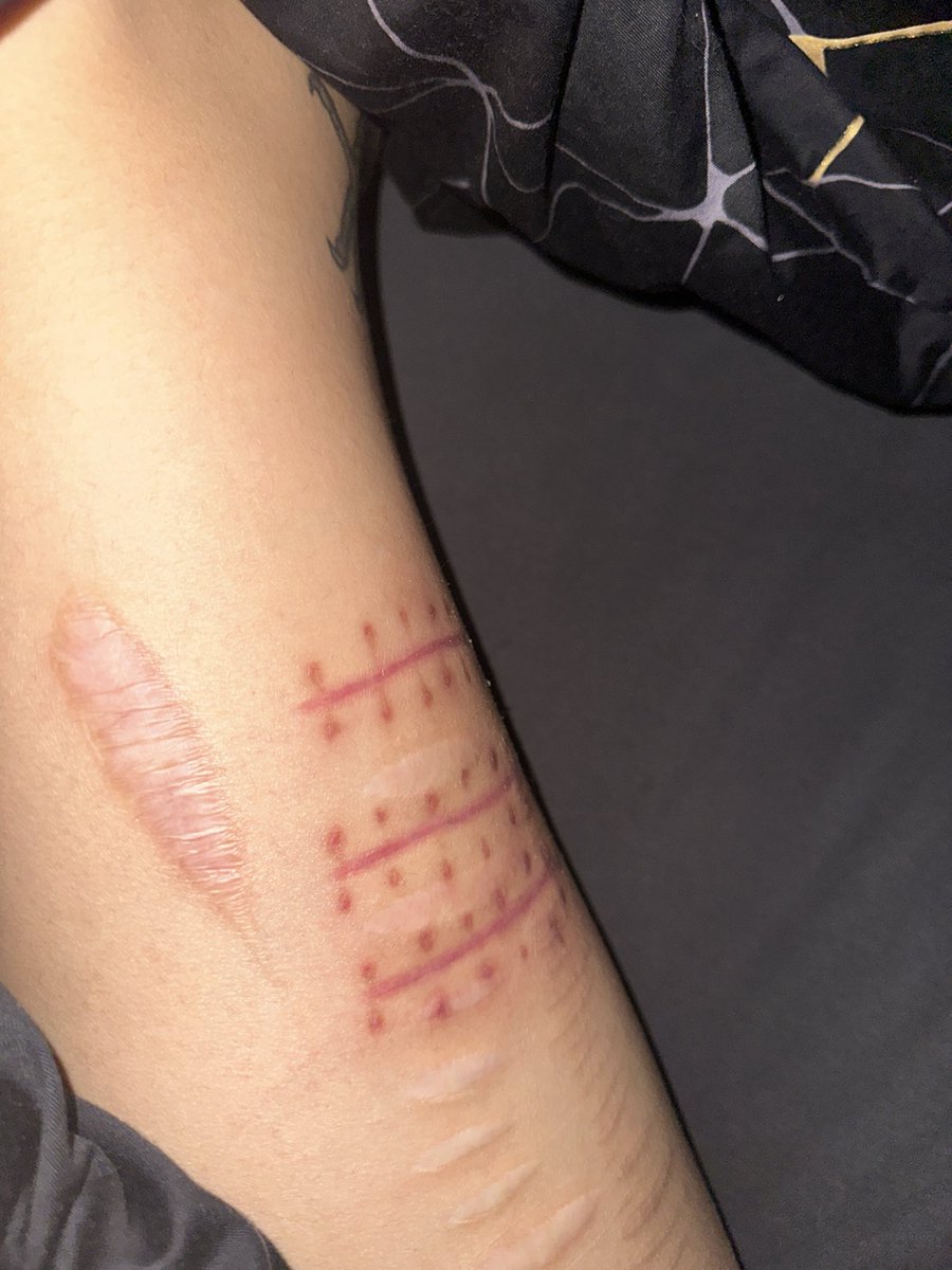 4 week old, almost scarred